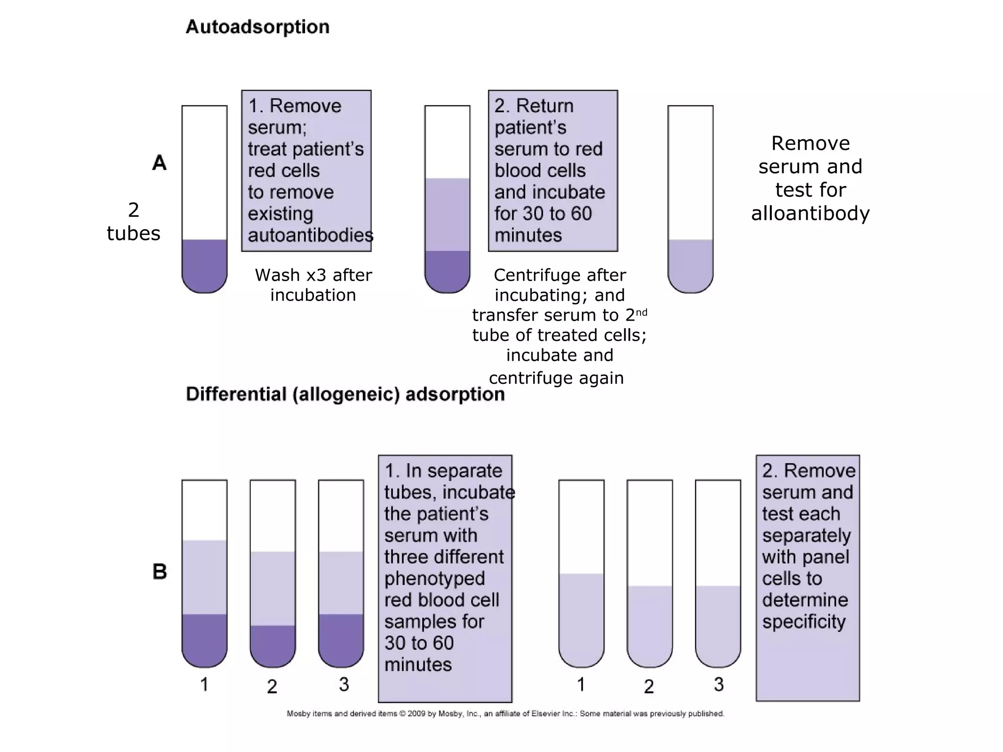 Wash x3 after
incubation
Centrifuge after
incubating; and
transfer serum to 2nd
tube of treated cells;
incubate and
centrifuge again
2
tubes
Remove
serum and
test for
alloantibody
 
