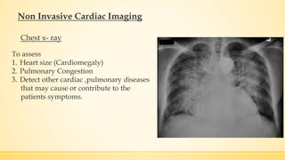To assess
1. Heart size (Cardiomegaly)
2. Pulmonary Congestion
3. Detect other cardiac ,pulmonary diseases
that may cause or contribute to the
patients symptoms.
Non Invasive Cardiac Imaging
Chest x- ray
 