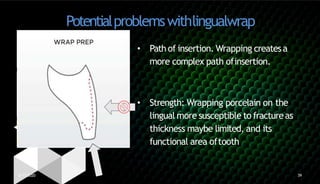 Ceramic veneers by DR. ABIJITH RAGHAVAN SRAMBIKAL | PPTX