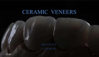CERAMIC VENEERS
ABIJITH R S
1 ST YEAR PG
5/17/2020 1
 