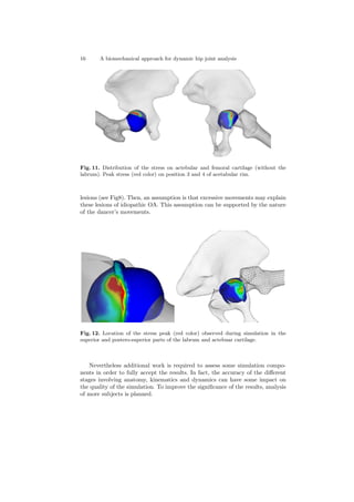 16 A biomechanical approach for dynamic hip joint analysis
Fig. 11. Distribution of the stress on actebular and femoral cartilage (without the
labrum). Peak stress (red color) on position 3 and 4 of acetabular rim.
lesions (see Fig8). Then, an assumption is that excessive movements may explain
these lesions of idiopathic OA. This assumption can be supported by the nature
of the dancer’s movements.
Fig. 12. Location of the stress peak (red color) observed during simulation in the
superior and postero-superior parts of the labrum and actebuar cartilage.
Nevertheless additional work is required to assess some simulation compo-
nents in order to fully accept the results. In fact, the accuracy of the diﬀerent
stages involving anatomy, kinematics and dynamics can have some impact on
the quality of the simulation. To improve the signiﬁcance of the results, analysis
of more subjects is planned.
 
