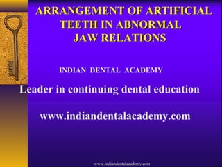 ARRANGEMENT OF ARTIFICIALARRANGEMENT OF ARTIFICIAL
TEETH IN ABNORMALTEETH IN ABNORMAL
JAW RELATIONSJAW RELATIONS
INDIAN DENTAL ACADEMY
Leader in continuing dental education
www.indiandentalacademy.com
www.indiandentalacademy.com
 