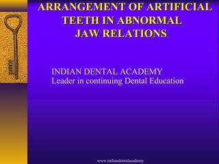 ARRANGEMENT OF ARTIFICIALARRANGEMENT OF ARTIFICIAL
TEETH IN ABNORMALTEETH IN ABNORMAL
JAW RELATIONSJAW RELATIONS
INDIAN DENTAL ACADEMY
Leader in continuing Dental Education
www.indiandentalacademy
 