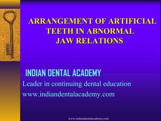 ARRANGEMENT OF ARTIFICIAL
TEETH IN ABNORMAL
JAW RELATIONS

INDIAN DENTAL ACADEMY
Leader in continuing dental education
www.indiandentalacademy.com

www.indiandentalacademy.com

 