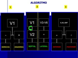 ALGORITMO
          1                        2                           3




          V1              V1           V3-V6            II, III, AVF




   -             +         V2            +          +                  -



DERECHA       IZQUIERDA   SEPTAL       LATERAL   ANTERIOR          POSTERIOR
 