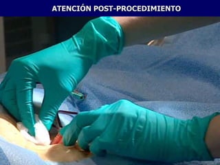 ATENCIÓN POST-PROCEDIMIENTO
 
