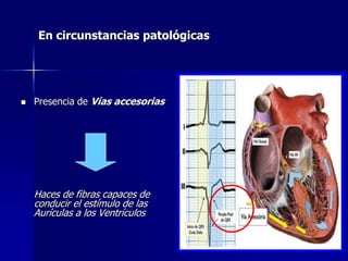 En circunstancias patológicas




   Presencia de Vías accesorias




    Haces de fibras capaces de
    conducir el estímulo de las
    Aurículas a los Ventrículos
 