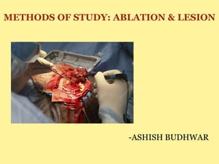 METHODS OF STUDY: ABLATION & LESION
-ASHISH BUDHWAR
 