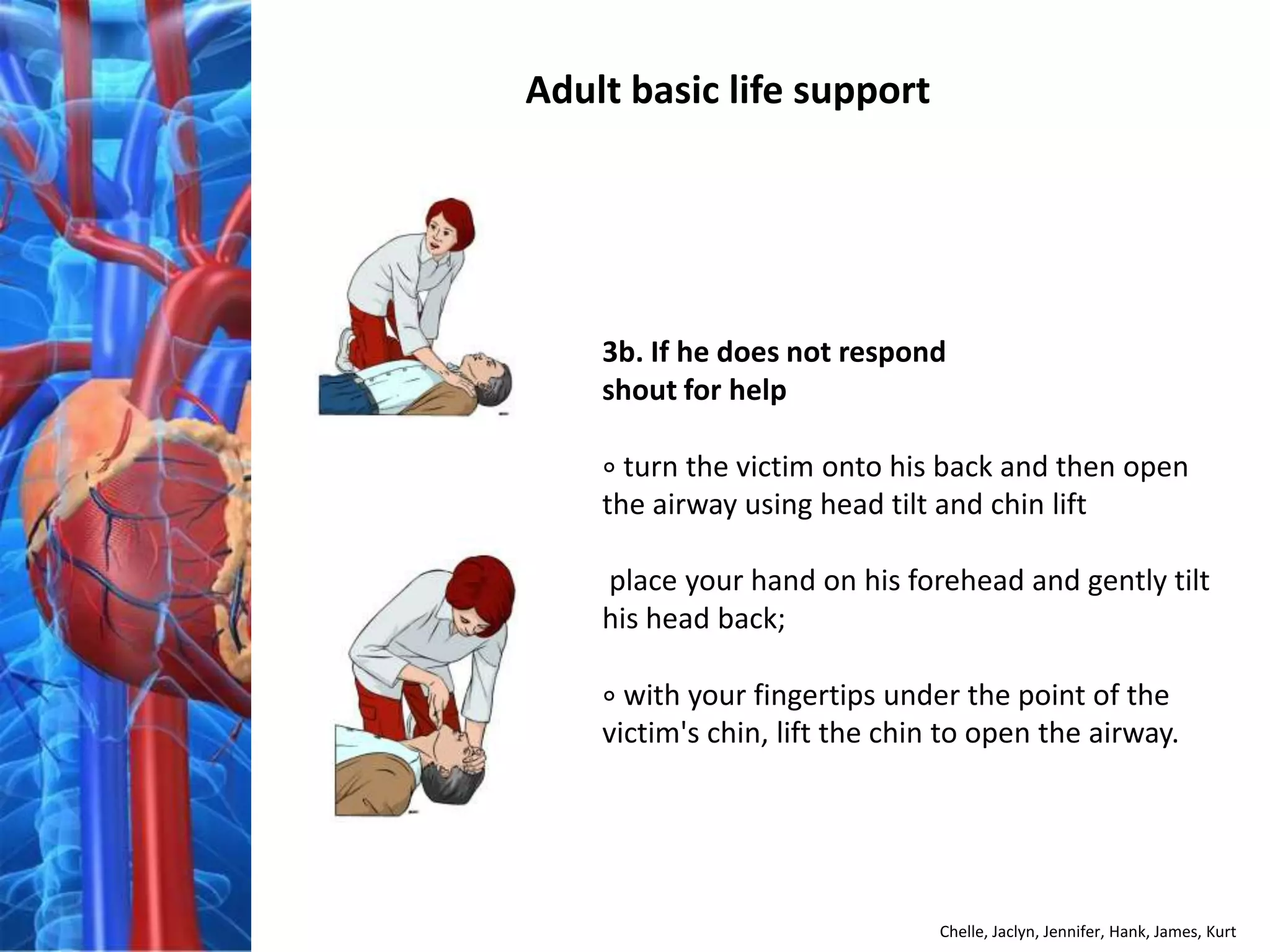 Adult basic life support




    3b. If he does not respond
    shout for help

    ∘ turn the victim onto his back and then open
    the airway using head tilt and chin lift

    place your hand on his forehead and gently tilt
    his head back;

    ∘ with your fingertips under the point of the
    victim's chin, lift the chin to open the airway.




                                Chelle, Jaclyn, Jennifer, Hank, James, Kurt
 