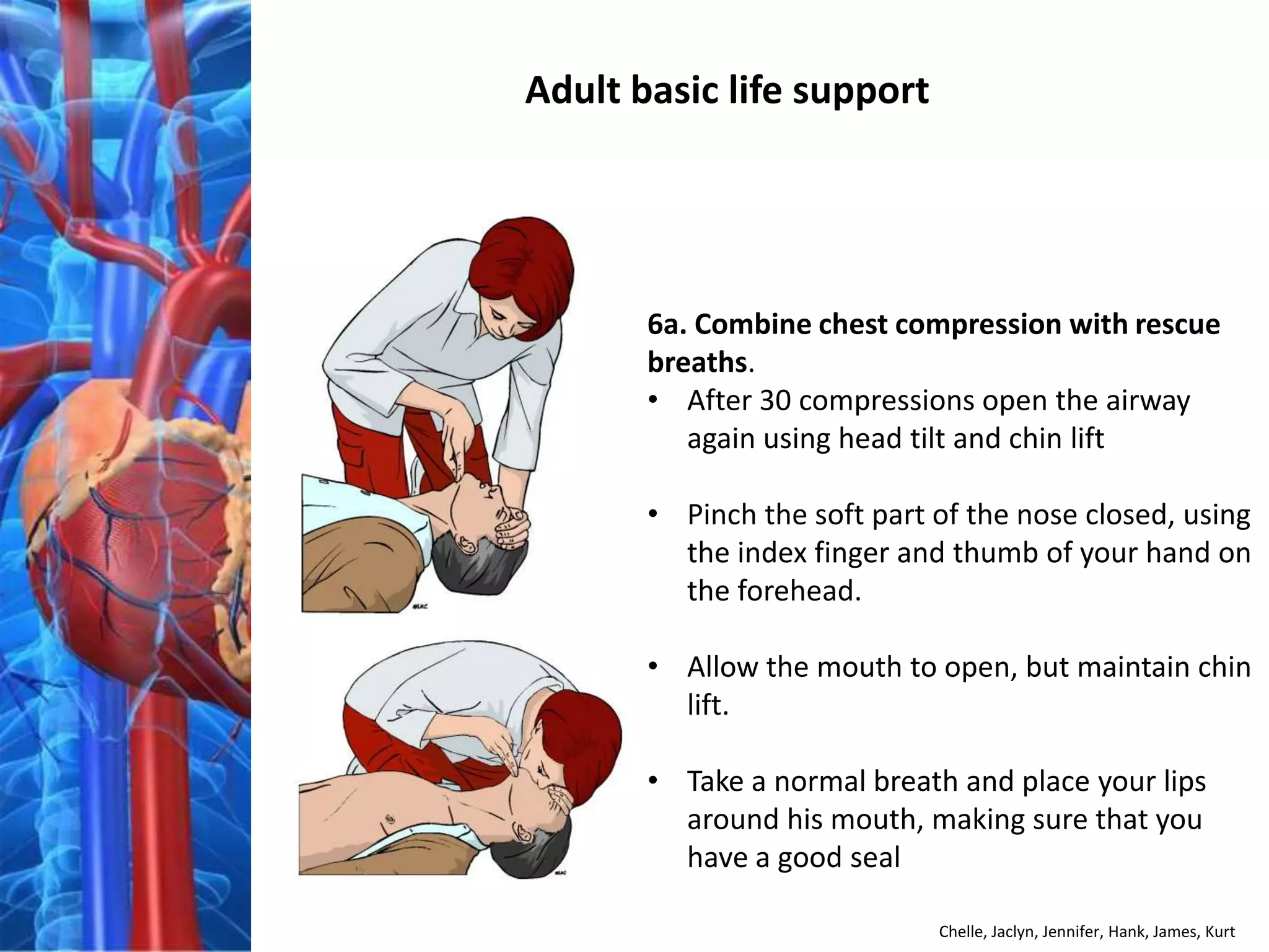 Adult basic life support




       6a. Combine chest compression with rescue
       breaths.
       • After 30 compressions open the airway
          again using head tilt and chin lift

       • Pinch the soft part of the nose closed, using
         the index finger and thumb of your hand on
         the forehead.

       • Allow the mouth to open, but maintain chin
         lift.

       • Take a normal breath and place your lips
         around his mouth, making sure that you
         have a good seal

                             Chelle, Jaclyn, Jennifer, Hank, James, Kurt
 