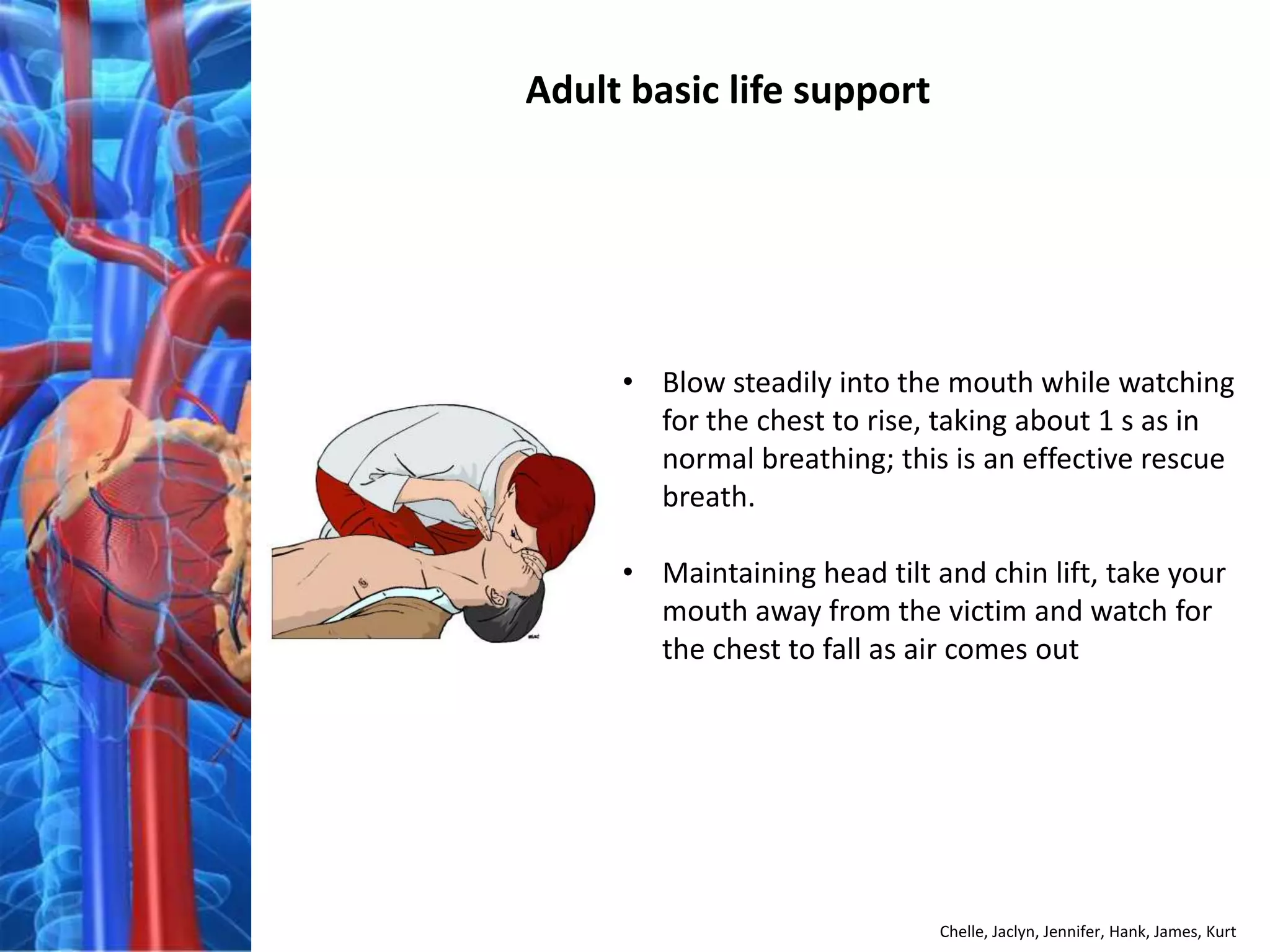 Adult basic life support




     • Blow steadily into the mouth while watching
       for the chest to rise, taking about 1 s as in
       normal breathing; this is an effective rescue
       breath.

     • Maintaining head tilt and chin lift, take your
       mouth away from the victim and watch for
       the chest to fall as air comes out




                              Chelle, Jaclyn, Jennifer, Hank, James, Kurt
 