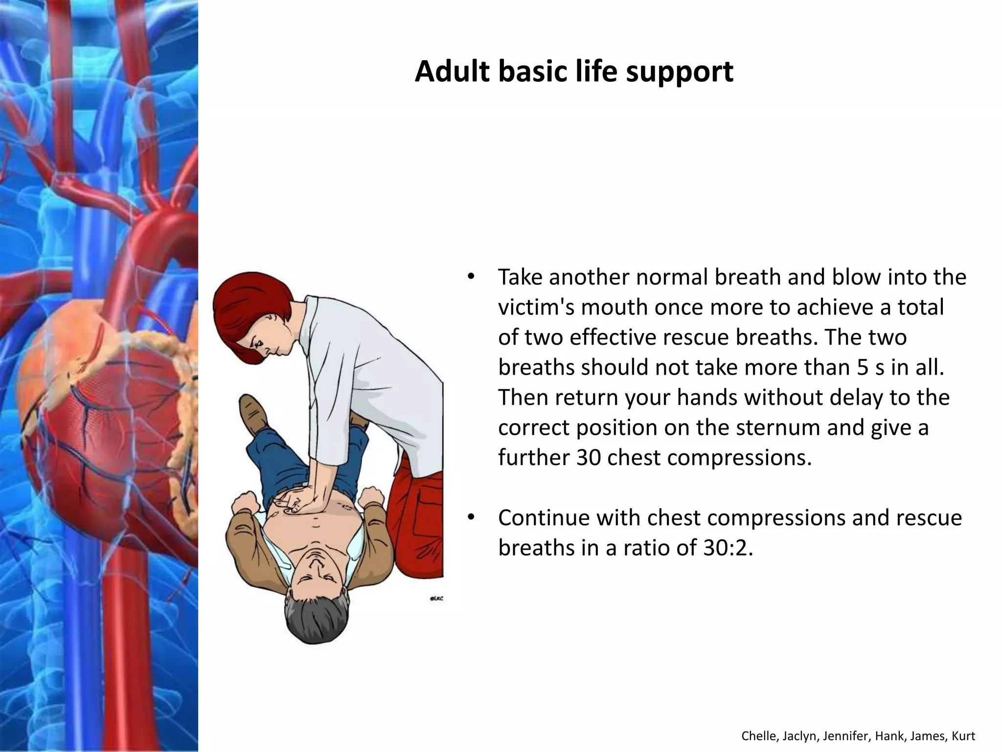 Adult basic life support




   • Take another normal breath and blow into the
     victim's mouth once more to achieve a total
     of two effective rescue breaths. The two
     breaths should not take more than 5 s in all.
     Then return your hands without delay to the
     correct position on the sternum and give a
     further 30 chest compressions.

   • Continue with chest compressions and rescue
     breaths in a ratio of 30:2.




                            Chelle, Jaclyn, Jennifer, Hank, James, Kurt
 