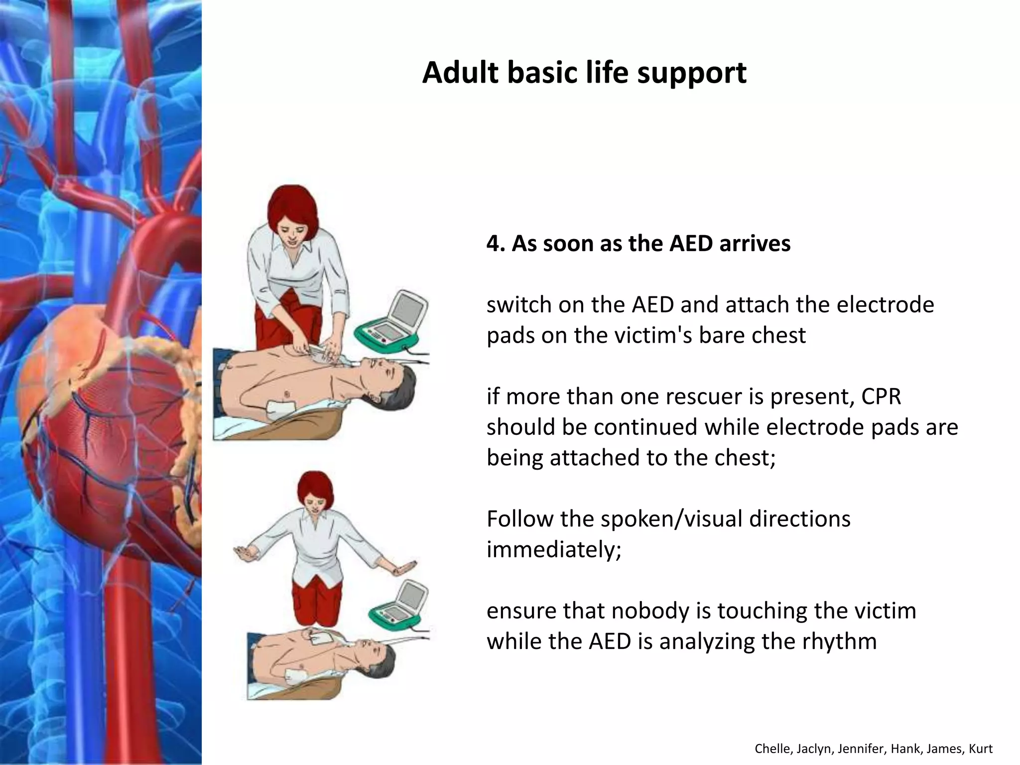 Adult basic life support



    4. As soon as the AED arrives

    switch on the AED and attach the electrode
    pads on the victim's bare chest

    if more than one rescuer is present, CPR
    should be continued while electrode pads are
    being attached to the chest;

    Follow the spoken/visual directions
    immediately;

    ensure that nobody is touching the victim
    while the AED is analyzing the rhythm



                             Chelle, Jaclyn, Jennifer, Hank, James, Kurt
 