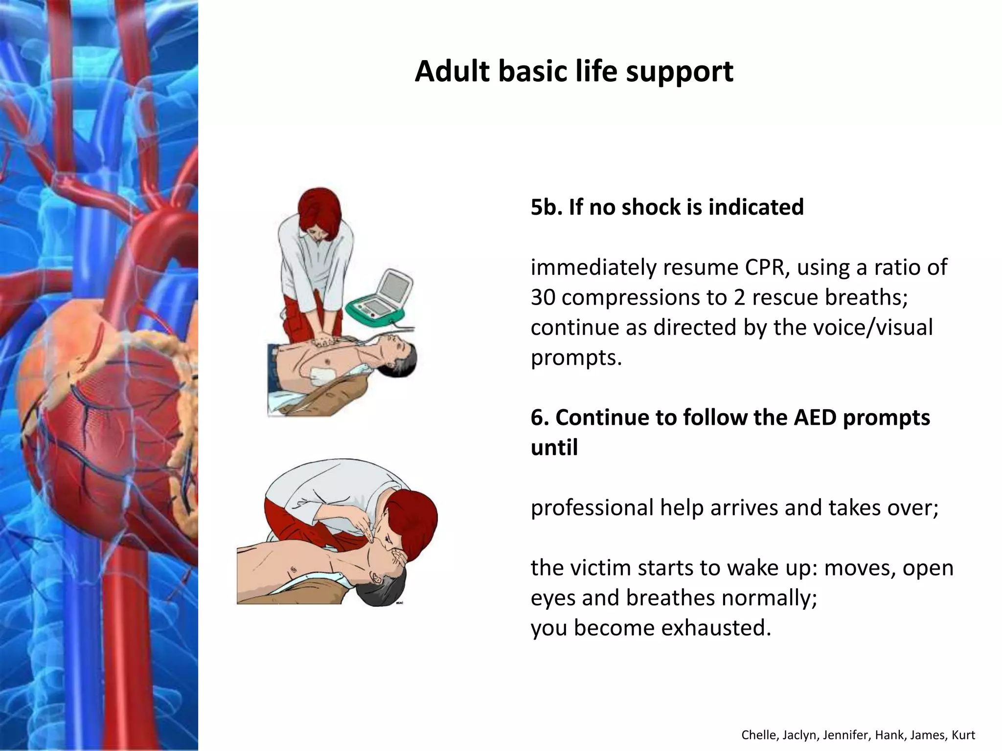 Adult basic life support


        5b. If no shock is indicated

        immediately resume CPR, using a ratio of
        30 compressions to 2 rescue breaths;
        continue as directed by the voice/visual
        prompts.

        6. Continue to follow the AED prompts
        until

        professional help arrives and takes over;

        the victim starts to wake up: moves, open
        eyes and breathes normally;
        you become exhausted.



                             Chelle, Jaclyn, Jennifer, Hank, James, Kurt
 