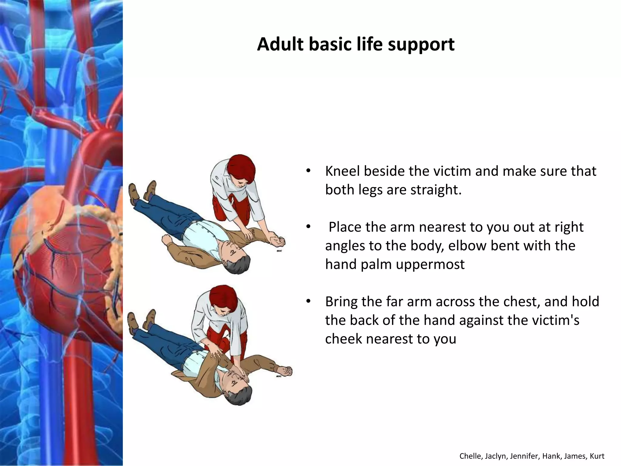 Adult basic life support




     • Kneel beside the victim and make sure that
       both legs are straight.

     •   Place the arm nearest to you out at right
         angles to the body, elbow bent with the
         hand palm uppermost

     • Bring the far arm across the chest, and hold
       the back of the hand against the victim's
       cheek nearest to you




                              Chelle, Jaclyn, Jennifer, Hank, James, Kurt
 