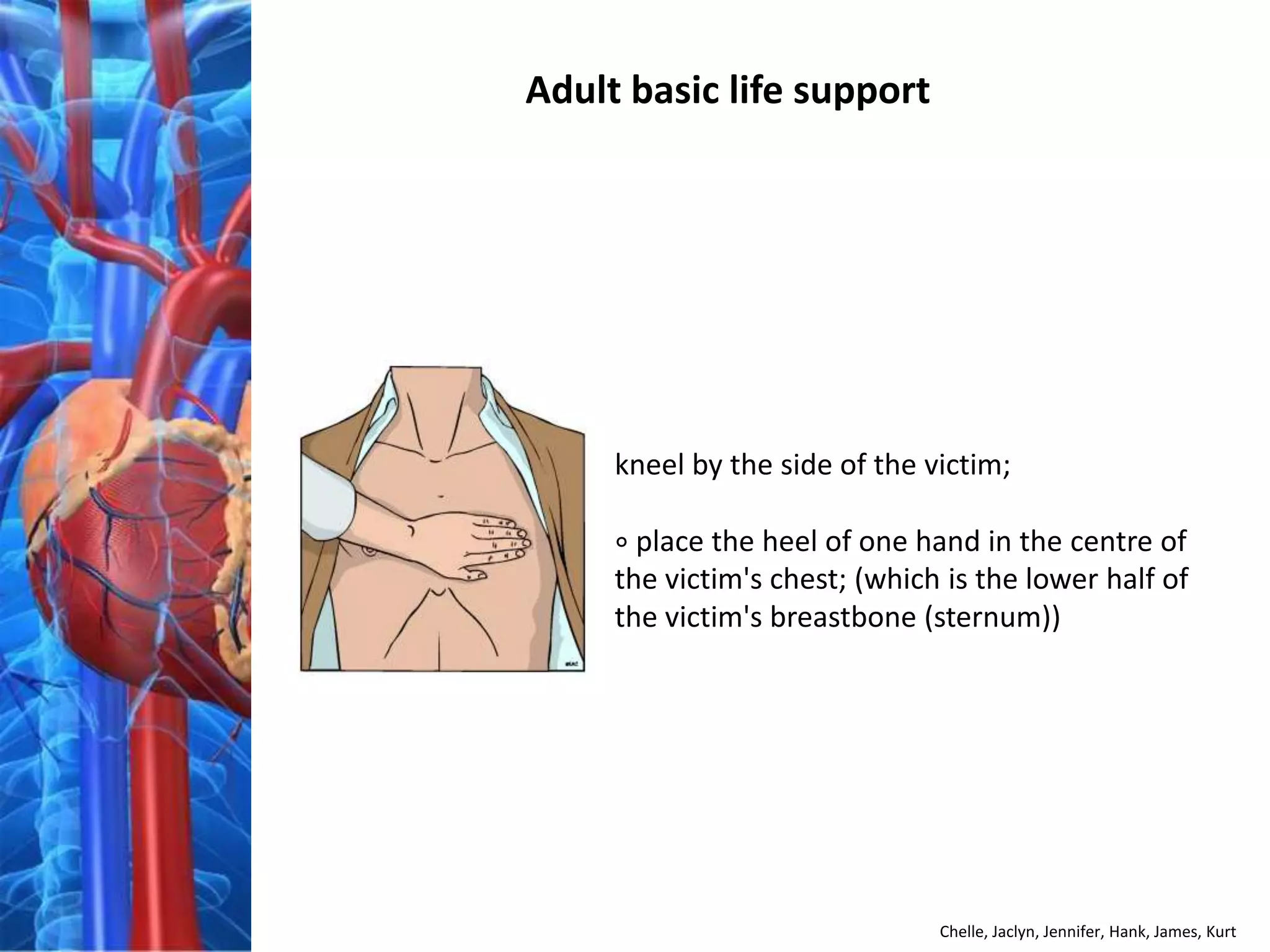 Adult basic life support




     kneel by the side of the victim;

     ∘ place the heel of one hand in the centre of
     the victim's chest; (which is the lower half of
     the victim's breastbone (sternum))




                               Chelle, Jaclyn, Jennifer, Hank, James, Kurt
 
