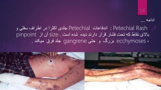‫ادامه‬
...
.7
Petechial Rash
:
‫اندفاعات‬
Petechial
‫و‬ ‫سفلی‬ ‫اطراف‬ ‫در‬ ‫اکثرا‬ ‫جلدی‬
‫دیده‬ ‫دارند‬ ‫قرار‬ ‫فشار‬ ‫تحت‬ ‫که‬ ‫نقاط‬ ‫باالی‬
‫شده‬
‫است‬
.
size
‫از‬ ‫آن‬
pinpoint
،
ecchymoses
‫بزرگ‬
‫و‬
‫حتی‬
gangrene
‫فرق‬ ‫جلد‬
‫میکند‬
.
54
 