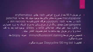 .6
‫در‬
‫جریان‬
96 h
‫بع‬
‫از‬ ‫د‬
‫شروع‬
‫اعراض‬
rash
‫جلدی‬
erythematous
maculopapular
‫باالی‬ ‫منتشر‬ ‫بصورت‬
‫جلد‬
‫میاید‬ ‫بوجود‬
.
‫که‬
‫بعدا‬
‫به‬
petechial
rash
‫و‬
‫بعد‬
‫به‬
purpuric rash
‫و‬
‫هرگاه‬
‫نشود‬ ‫تداوی‬
‫به‬
skin necrosis
‫و‬
gangrene
‫مینماید‬ ‫تحول‬
.
‫رنگ‬
‫آن‬
‫از‬
‫سرخ‬
‫روشن‬
‫سرخ‬ ‫به‬
‫تاریک‬
‫به‬
‫زرد‬
‫نصواری‬
‫و‬
‫ب‬
‫ا‬
‫الخره‬
‫سیاه‬
‫تغیر‬
‫میکند‬
.
‫ابتدا‬
‫باالی‬
wrist
‫و‬
ankles
‫بوجود‬
‫آمده‬
‫بعد‬
‫به‬
‫کف‬
‫و‬ ‫دست‬
‫ﭙ‬
‫ا‬
‫و‬
‫جریان‬ ‫در‬
‫چند‬
‫به‬ ‫ساعت‬
‫تمام‬
‫عضویت‬
‫انتشار‬
‫میابد‬
.
•
‫توسط‬ ‫مرض‬ ‫تشخیص‬
staining
immunofluorescent
‫نمونه‬
biopsy
‫جلد‬
‫میگیرد‬ ‫صورت‬
.
•
‫تداوی‬
‫با‬
100 mg bid
Doxycycline
‫صورت‬
‫میگیرد‬
.
65
 