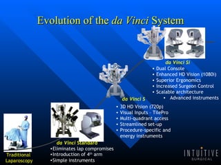 Evolution of the  da Vinci  System Traditional  Laparoscopy Introduction of 4 th  arm Simple instruments Eliminates lap compromises da Vinci  Standard Dual Console Enhanced HD Vision (1080i) Superior Ergonomics Increased Surgeon Control  Scalable architecture Advanced instruments da Vinci Si 3D HD Vision (720p)  Visual Inputs – TilePro Multi-quadrant access Streamlined set-up Procedure-specific and energy instruments da Vinci S 