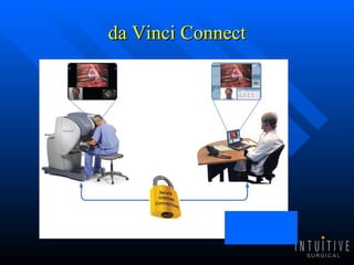 da Vinci Connect 