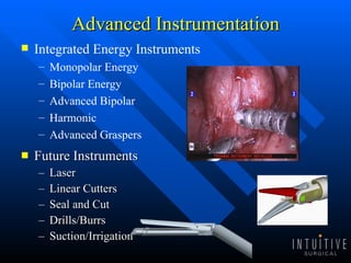 Advanced Instrumentation Future Instruments Laser Linear Cutters Seal and Cut Drills/Burrs Suction/Irrigation Integrated Energy Instruments Monopolar Energy Bipolar Energy Advanced Bipolar Harmonic Advanced Graspers 