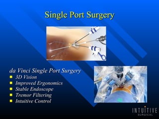 Single Port Surgery da Vinci Single Port Surgery  3D Vision  Improved Ergonomics  Stable Endoscope Tremor Filtering Intuitive Control  