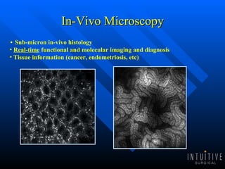 In-Vivo Microscopy Sub-micron in-vivo histology Real-time  functional and molecular imaging and diagnosis Tissue information (cancer, endometriosis, etc) 