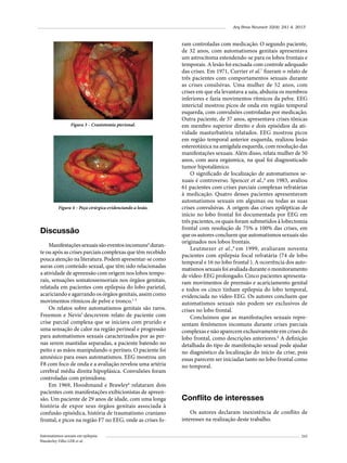 Arq Bras Neurocir 32(4): 241-4, 2013

Figura 3 – Craniotomia pterional.

Figura 4 – Peça cirúrgica evidenciando a lesão.

Discussão
Manifestações sexuais são eventos incomuns4 durante ou após as crises parciais complexas que têm recebido
pouca atenção na literatura. Podem apresentar-se como
auras com conteúdo sexual, que têm sido relacionadas
a atividade de apreensão com origem nos lobos temporais, sensações somatossensoriais nos órgãos genitais,
relatada em pacientes com epilepsia do lobo parietal,
acariciando e agarrando os órgãos genitais, assim como
movimentos rítmicos de pelve e tronco.1-3
Os relatos sobre automatismos genitais são raros.
Freemon e Nevis5 descrevem relato de paciente com
crise parcial complexa que se iniciava com prurido e
uma sensação de calor na região perineal e progressão
para automatismos sexuais caracterizados por as pernas serem mantidas separadas, a paciente batendo no
peito e as mãos manipulando o períneo. O paciente foi
amnésico para esses automatismos. EEG mostrou um
F8 com foco de onda e a avaliação revelou uma artéria
cerebral média direita hipoplásica. Convulsões foram
controladas com primidona.
Em 1969, Hooshmand e Brawley6 relataram dois
pacientes com manifestações exibicionistas de apreensão. Um paciente de 29 anos de idade, com uma longa
história de expor seus órgãos genitais associada à
confusão episódica, história de traumatismo craniano
frontal, e picos na região F7 no EEG, onde as crises foAutomatismos sexuais em epilepsia
Wanderley Filho LER et al.

ram controladas com medicação. O segundo paciente,
de 32 anos, com automatismos genitais apresentava
um astrocitoma estendendo-se para os lobos frontais e
temporais. A lesão foi excisada com controle adequado
das crises. Em 1971, Currier et al.7 fizeram o relato de
três pacientes com comportamentos sexuais durante
as crises conulsivas. Uma mulher de 52 anos, com
crises em que ela levantava a saia, abduzia os membros
inferiores e fazia movimentos rítmicos da pelve. EEG
interictal mostrou picos de onda em região temporal
esquerda, com convulsões controladas por medicação.
Outra paciente, de 37 anos, apresentava crises tônicas
em membro superior direito e dois episódios da atividade masturbatória relatados. EEG mostrou picos
em região temporal anterior esquerda, realizou lesão
estereotáxica na amígdala esquerda, com resolução das
manifestações sexuais. Além disso, relata mulher de 50
anos, com aura orgásmica, na qual foi diagnosticado
tumor hipotalâmico.
O significado de localização de automatismos sexuais é controverso. Spencer et al.,8 em 1983, avaliou
61 pacientes com crises parciais complexas refratárias
à medicação. Quatro desses pacientes apresentavam
automatismos sexuais em algumas ou todas as suas
crises convulsivas. A origem das crises epilépticas de
início no lobo frontal foi documentada por EEG em
três pacientes, os quais foram submetidos à lobectomia
frontal com resolução de 75% a 100% das crises, em
que os autores concluem que automatismos sexuais são
originados nos lobos frontais.
Leutmezer et al., 9 em 1999, avaliaram noventa
pacientes com epilepsia focal refratária (74 de lobo
temporal e 16 no lobo frontal ). A ocorrência dos automatismos sexuais foi avaliada durante o monitoramento
de vídeo-EEG prolongado. Cinco pacientes apresentaram movimentos de preensão e acariciamento genital
e todos os cinco tinham epilepsia do lobo temporal,
evidenciada no vídeo-EEG. Os autores concluem que
automatismos sexuais não podem ser exclusivos de
crises no lobo frontal.
Concluímos que as manifestações sexuais representam fenômenos incomuns durante crises parciais
complexas e não aparecem exclusivamente em crises do
lobo frontal, como descrições anteriores.8 A definição
detalhada do tipo de manifestação sexual pode ajudar
no diagnóstico da localização do início da crise, pois
essas parecem ser iniciadas tanto no lobo frontal como
no temporal.

Conflito de interesses
Os autores declaram inexistência de conflito de
interesses na realização deste trabalho.
243

 