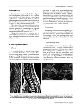 Arq Bras Neurocir 32(4): 245-9, 2013

Introduction

evacuation for three weeks, but no anal sphincter
dysfunction could be identified. She claimed that she
was feeling no pain. The symptoms, however, had begun,
approximately, two months before admission. She had
already searched for medical help at another institution
one month prior, when a computed tomography (CT) of
the lumbar spine had been performed. The CT proved to
be normal and the doctor’s advice was physical therapy.
However no improvement could be observed.

Neurocysticercosis is caused by the larval stage of
the pork tapeworm Taenia solium.1 In 1913, Ferguson
apud Qi et al.2 was the first to describe a case of spinal
cysticercosis. Cysticercosis is the most common
parasitic infection affecting the central nervous system.
However, the spinal cysticercosis is rare, representing
0.7% to 5.8% of all cases of neurocysticercosis.
This disease has been classified anatomically
as extraspinal (vertebral) or intraspinal (epidural,
subdural, arachnoid, or intramedullary), of which the
intramedullary type is quite rare. In fact, only 55 cases
have been reported up to January of 2011.2-4
The present study aims to report a case of
intramedullary cysticercosis at T2 and T3 vertebral
levels and discuss its diagnosis and treatment through
a literature review.

Examination
Neurological examination revealed spastic paraparesis with a decreased motor power of grade 3/5 in
both lower limbs and impaired sensations below the
T6 dermatome. Clonus, brisk tendon jerks and signs
of positive Babinski could be identified on both sides
of the body.

Complementary exams

Clinical presentation

Contrast MRI revealed a round intramedullary
cystic lesion at T2 and T3 vertebral levels, which were
homogeneously hypointense with hyperintense ring on
T1WI and hyperintense on T2WI with a hyperintense
signal on the adjacent level. The subarachnoid space
from T2 to T3 was narrow due to the marked expansion
of the spinal cord (Figure 1A-C). No abnormalities
could be observed at the cervical level or within the
brain parenchyma.

History
A previously healthy 28-year-old female patient
was admitted to the Odilon Behrens hospital after a
fall equal to the patient’s height. The patient reported
progressive walking difficulties and impaired sensations
in both lower limbs, but worse in the right lower limb.
She also reported having suffered of incomplete bladder
A

B

C

Figure 1 – (A) Sagital T2WI MR image of the cervicothoracic region demonstrating round intramedullary cystic lesion at T2 and T3 vertebral
levels, hyperintense on T2WI with a hyperintense signal on the adjacent levels. The subarachnoid space from T2 to T3 was narrow due to
the marked expansion of the spinal cord. (B) Sagital T1WI MR image demonstrating the same cystic lesion, hypointense with a hyperintense
ring. (C) Axial non – contrast T2WI image of T2/T3 level.
246

Spinal intramedullary cysticercosis: case report
Araujo ABS et al.

 