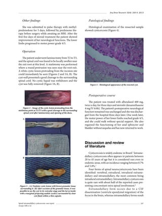 Arq Bras Neurocir 32(4): 245-9, 2013

Other findings
She was submitted to pulse therapy with methylprednisolone for 5 days, followed by prednisone therapy before surgery while awaiting an MRI. After the
first five days of steroid treatment the patient showed
improvement of her neurological functions. The lower
limbs progressed to motor power grade 4/5.

Patological findings
Histological examination of the ressected sample
showed cysticercosis (Figure 4).

Operation
The patient underwent laminectomy from T2 to T3,
and the spinal cord was found to be locally swollen near
the exit root at this level. A mielotomy was performed
where a round protrusion was seen near the root exit.
A white cystic lesion protruding from the incision site
could immediately be seen (Figures 2 and 3A, B). The
cyst wall presented a good cleavage to the surrounding
spinal cord. No cystic liquid was withdrawn and the
cyst was fully removed (Figure 3A, B).

Figure 4 – Histological appearance of the resected cyst.

Postoperative course

Figure 2 – Image of the cystic lesion protunding from the
mielotomy point at T2/T3 with a good cleavage to the surrounding
spinal cord after laminectomy and opening of the dura.
A

The patient was treated with albendazol 400 mg,
twice a day, for three days and steroids (dexamethasone
4 mg IV 6/6h). The patient’s postoperative neurological
function remained was unchanged and she was discharged from the hospital three days later. One week later,
the motor power of her lower limbs reached grade 4/5,
and she could walk without special support. She also
regained the functioning of her anal sphincter and
bladder without sequelas and has now returned to work.

Discussion and review
of literature
B

Figure 3 – (A) Nodular cystic lesion with brown granular tissue
surrounding it. (B) After excision of the granular tissue, it was
possible to see the cyst in its vesicular stage and the larva inside
with a marginal projecting nodule (scolex) surrounded by clear
cyst fluid within a thin capsule.
Spinal intramedullary cysticercosis: case report
Araujo ABS et al.

Cysticercosis is widely endemic in Brazil.5 Intramedullary cysticercosis often appears in patients between
20 to 45 years of age but it is considered rare even in
endemic areas, with an incidence ranging between 0.7%
and 5.8%.2
Four forms of spinal neurocysticercosis have been
identified: vertebral, extradural, intradural extramedullary and intramedullary, the most common being
intradural extramedullary. Intramedullary cysticercosis
is quite rare with about half of the reported cases presenting concomitant extra spinal involvement.6
Extramedullary form occurs due to a CSF
dissemination (ventricle ependymal migration) of the
focus in the brain, whereas intramedullary forms result
247

 