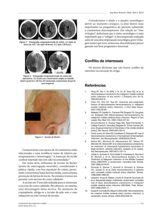 Arq Bras Neurocir 32(4): 250-4, 2013

Figura 1 – Tomografia computadorizada de crânio. (A) Após 24
horas do AVC. (B) Após 48 horas. (C) Após 120 horas.

Consideramos a idade e o quadro neurológico
prévio ao momento cirúrgico, os dois fatores mais
importantes no prognóstico do paciente submetido
à craniotomia descompressiva. Em relação ao “time
cirúrgico”, deduzimos que o status neurológico é mais
importante que o “relógio”. A descompressão realizada
antes de uma descompensação neurológica grave (Glasgow menor que nove, anisocoria, descerebração) parece
garantir um bom prognóstico funcional.

Conflito de interesses
Os autores declaram que não houve conflito de
interesses na execução do artigo.
Figura 2 – Tomografia computadorizada de crânio pós-operatória. (A) Axial com craniectomia ampla no sentido
ântero-posterior. (B) Em AP mostrando craniectomia basal do
osso temporal.

Referências
1.	

2.	

3.	

4.	

5.	

Figura 3 – Incisão de Becker.
6.	

Craniectomias com menos de 10 centímetros estão
relacionadas a uma incidência maior de infartos parenquimatosos e hemorragias.6 A ressecção do tecido
cerebral infartado não tem sido recomendada.6,7
Em nossa série, utilizamos da incisão de Becker
(ponto de interrogação invertido), considerando-a
prática, rápida, com boa exposição do crânio, permitindo craniectomia basal da fossa média, essencial para
prevenção de hérnia de úncus. No entanto, tivemos um
paciente com necrose do couro cabeludo.
A incisão em T tem sido utilizada para se minimizar
a necrose do couro cabeludo. Percebemos, no entanto,
uma desvantagem dessa técnica. No momento da
cranioplastia, obriga-se a incisão da pele sem o osso
subjacente no eixo vertical da incisão.
Craniotomia descompressiva: análise
Rocha Júnior MA et al.

7.	

8.	

9.	

10.	

Yang XF, Yao Y, Hu WW, Li G, Xu JF, Zhao XQ, et al. Is
decompressive craniectomy for malignant middle cerebral
artery infarction of any worth? J Zhejiang Univ Sci B.
2005;6(7):644-9.
Chen CC, Cho DY, Tsai SC. Outcome and prognostic
factors of decompressive hemicraniectomy in malignant
middle cerebral artery infarction. J Chin Med Assoc.
2007;70(2):56-60.
Mellado TP, Castillo FL, Campos PM, Bugedo TG, Dougnac
LA, Andresen HM. [Decompressive hemicraniectomy for
malignant middle cerebral artery infarction. Report of two
cases]. Rev Med Chil. 2005;133(4):447-52.
Antuña-Ramos A, Alvarez-Vega MA, Seijo-Fernández F,
Calleja-Puerta S, González-Delgado M, Torres-Campa JM,
et al. [Surgical treatment of the stroke in the middle cerebral
artery]. Rev Neurol. 2009;49(7):354-8.
Fiorot Junior JA, Silva GS, Cavalheiro S, Massaro AR. Use of
decompressive craniectomy in the treatment of hemispheric
infarction. Arq Neuropsiquiatr. 2008;66(2A):204-8.
Nobre MC, Monteiro M, Albuquerque AC, Veloso AT,
Mendes VA, Silveira MF, et al. [Decompressive craniectomy
for treatment of intracranial hypertension secondary to
large ischemic cerebral infarction: analysis of 34 cases].
Arq Neuropsiquiatr. 2007;65(1):107-13.
Jüttler E, Schwab S, Schmiedek P, Unterberg A, Hennerici
M, Woitzik J, et al. Decompressive Surgery for the
Treatment of Malignant Infarction of the Middle Cerebral
Artery (DESTINY): a randomized, controlled trial. Stroke.
2007;38(9):2518-25.
Schwab S, Steiner T, Aschoff A, Schwarz S, Steiner
HH, Jansen O, et al. Early hemicraniectomy in patients
with complete middle cerebral artery infarction. Stroke.
1998;29(9):1888-93.
Vahedi K, Vicaut E, Mateo J, Kurtz A, Orabi M, Guichard JP,
et al. Sequential-design, multicenter, randomized, controlled
trial of early decompressive craniectomy in malignant
middle cerebral artery infarction (DECIMAL Trial). Stroke.
2007;38(9):2506-17.
Gupta R, Connolly ES, Mayer S, Elkind MS. Hemicraniectomy
for massive middle cerebral artery territory infarction: a
systematic review. Stroke. 2004;35(2):539-43.
253

 