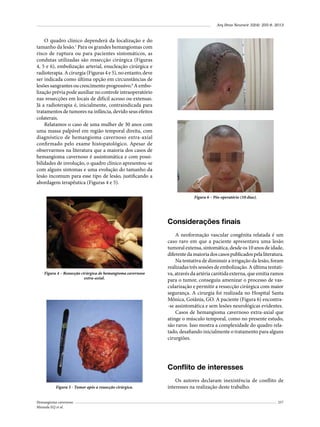 Arq Bras Neurocir 32(4): 255-8, 2013

O quadro clínico dependerá da localização e do
tamanho da lesão.1 Para os grandes hemangiomas com
risco de ruptura ou para pacientes sintomáticos, as
condutas utilizadas são ressecção cirúrgica (Figuras
4, 5 e 6), embolização arterial, enucleação cirúrgica e
radioterapia. A cirurgia (Figuras 4 e 5), no entanto, deve
ser indicada como última opção em circunstâncias de
lesões sangrantes ou crescimento progressivo.6 A embolização prévia pode auxiliar no controle intraoperatório
nas ressecções em locais de difícil acesso ou extensas.
Já a radioterapia é, inicialmente, contraindicada para
tratamentos de tumores na infância, devido seus efeitos
colaterais.
Relatamos o caso de uma mulher de 30 anos com
uma massa palpável em região temporal direita, com
diagnóstico de hemangioma cavernoso extra-axial
confirmado pelo exame histopatológico. Apesar de
observarmos na literatura que a maioria dos casos de
hemangioma cavernoso é assintomática e com possibilidades de involução, o quadro clínico apresentou-se
com alguns sintomas e uma evolução do tamanho da
lesão incomum para esse tipo de lesão, justificando a
abordagem terapêutica (Figuras 4 e 5).
Figura 6 – Pós-operatório (10 dias).

Considerações finais

Figura 4 – Ressecção cirúrgica de hemangioma cavernoso
extra-axial.

A neoformação vascular congênita relatada é um
caso raro em que a paciente apresentava uma lesão
tumoral extensa, sintomática, desde os 10 anos de idade,
diferente da maioria dos casos publicados pela literatura.
Na tentativa de diminuir a irrigação da lesão, foram
realizadas três sessões de embolização. A última tentativa, através da artéria carótida externa, que emitia ramos
para o tumor, conseguiu amenizar o processo de vascularização e permitir a ressecção cirúrgica com maior
segurança. A cirurgia foi realizada no Hospital Santa
Mônica, Goiânia, GO. A paciente (Figura 6) encontra-se assintomática e sem lesões neurológicas evidentes.
Casos de hemangioma cavernoso extra-axial que
atinge o músculo temporal, como no presente estudo,
são raros. Isso mostra a complexidade do quadro relatado, desafiando inicialmente o tratamento para alguns
cirurgiões.

Conflito de interesses
Figura 5 - Tumor após a ressecção cirúrgica.
Hemangioma cavernoso
Miranda EQ et al.

Os autores declaram inexistência de conflito de
interesses na realização deste trabalho.
257

 
