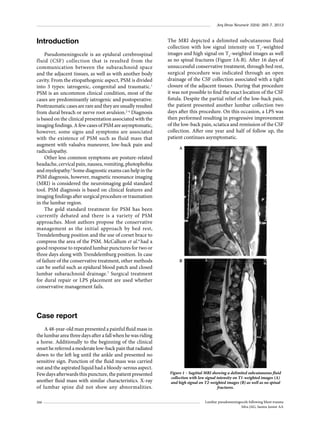 Arq Bras Neurocir 32(4): 265-7, 2013

Introduction
Pseudomeningocele is an epidural cerebrospinal
fluid (CSF) collection that is resulted from the
communication between the subarachnoid space
and the adjacent tissues, as well as with another body
cavity. From the etiopathogenic aspect, PSM is divided
into 3 types: iatrogenic, congenital and traumatic.1
PSM is an uncommon clinical condition, most of the
cases are predominantly iatrogenic and postoperative.
Posttraumatic cases are rare and they are usually resulted
from dural breach or nerve root avulsion.2-4 Diagnosis
is based on the clinical presentation associated with the
imaging findings. A few cases of PSM are asymptomatic,
however, some signs and symptoms are associated
with the existence of PSM such as fluid mass that
augment with valsalva maneuver, low-back pain and
radiculopathy.
Other less common symptoms are posture-related
headache, cervical pain, nausea, vomiting, photophobia
and myelopathy.5 Some diagnostic exams can help in the
PSM diagnosis, however, magnetic resonance imaging
(MRI) is considered the neuroimaging gold standard
tool. PSM diagnosis is based on clinical features and
imaging findings after surgical procedure or traumatism
in the lumbar region.
The gold standard treatment for PSM has been
currently debated and there is a variety of PSM
approaches. Most authors propose the conservative
management as the initial approach by bed rest,
Trendelemburg position and the use of corset brace to
compress the area of the PSM. McCallum et al.6 had a
good response to repeated lumbar punctures for two or
three days along with Trendelemburg position. In case
of failure of the conservative treatment, other methods
can be useful such as epidural blood patch and closed
lumbar subarachnoid drainage.7 Surgical treatment
for dural repair or LPS placement are used whether
conservative management fails.

The MRI depicted a delimited subcutaneous fluid
collection with low signal intensity on T1-weighted
images and high signal on T2-weighted images as well
as no spinal fractures (Figure 1A-B). After 16 days of
unsuccessful conservative treatment, through bed rest,
surgical procedure was indicated through an open
drainage of the CSF collection associated with a tight
closure of the adjacent tissues. During that procedure
it was not possible to find the exact location of the CSF
fistula. Despite the partial relief of the low-back pain,
the patient presented another lumbar collection two
days after this procedure. On this occasion, a LPS was
then performed resulting in progressive improvement
of the low-back pain, sciatica and remission of the CSF
collection. After one year and half of follow up, the
patient continues asymptomatic.
A

B

Case report
A 48-year-old man presented a painful fluid mass in
the lumbar area three days after a fall when he was riding
a horse. Additionally to the beginning of the clinical
onset he referred a moderate low-back pain that radiated
down to the left leg until the ankle and presented no
sensitive sign. Punction of the fluid mass was carried
out and the aspirated liquid had a bloody-serous aspect.
Few days afterwards this puncture, the patient presented
another fluid mass with similar characteristics. X-ray
of lumbar spine did not show any abnormalities.
266

Figure 1 – Sagittal MRI showing a delimited subcutaneous fluid
collection with low signal intensity on T1-weighted images (A)
and high signal on T2-weighted images (B) as well as no spinal
fractures.
Lumbar pseudomeningocele following blunt trauma
Silva JAG, Santos Junior AA

 
