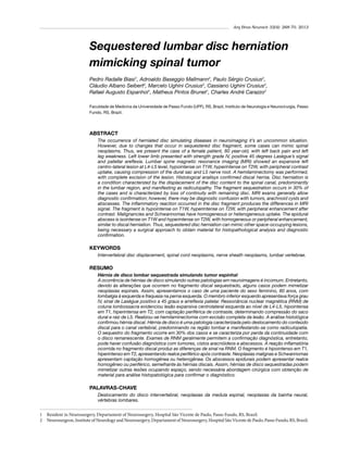 Arq Bras Neurocir 32(4): 268-70, 2013

Sequestered lumbar disc herniation
mimicking spinal tumor
Pedro Radalle Biasi1, Adroaldo Baseggio Mallmann2, Paulo Sérgio Crusius2,
Cláudio Albano Seibert2, Marcelo Ughini Crusius2, Cassiano Ughini Crusius2,
Rafael Augusto Espanhol1, Matheus Pintos Brunet1, Charles André Carazzo2
Faculdade de Medicina da Universidade de Passo Fundo (UPF), RS, Brazil, Instituto de Neurologia e Neurocirurgia, Passo
Fundo, RS, Brazil.

ABSTRACT
The occurrence of herniated disc simulating diseases in neuroimaging it’s an uncommon situation.
However, due to changes that occur in sequestered disc fragment, some cases can mimic spinal
neoplasms. Thus, we present the case of a female patient, 60 year-old, with left back pain and left
leg weakness. Left lower limb presented with strength grade IV, positive 45 degress Lasègue’s signal
and patellar areflexia. Lumbar spine magnetic resonance imaging (MRI) showed an expansive left
centro-lateral lesion at L4-L5 level, hypointense on T1W, hyperintense on T2W, with peripheral contrast
uptake, causing compression of the dural sac and L5 nerve root. A hemilaminectomy was performed,
with complete excision of the lesion. Histological analisys confirmed discal hernia. Disc herniation is
a condition characterized by the displacement of the disc content to the spinal canal, predominantly
in the lumbar region, and manifesting as radiculopathy. The fragment sequestration occurs in 30% of
the cases and is characterized by loss of continuity with remaining disc. MRI exams generally allow
diagnostic confirmation; however, there may be diagnostic confusion with tumors, arachnoid cysts and
abscesses. The inflammatory reaction occurred in the disc fragment produces the differences in MRI
signal. The fragment is hypointense on T1W, hyperintense on T2W, with peripheral enhancement after
contrast. Malignancies and Schwannomas have homogeneous or heterogeneous uptake. The epidural
abscess is isointense on T1W and hyperintense on T2W, with homogeneous or peripheral enhancement,
similar to discal herniation. Thus, sequestered disc herniation can mimic other space-occupying lesions,
being necessary a surgical approach to obtain material for histopathological analysis and diagnostic
confirmation.

KEYWORDS
Intervertebral disc displacement, spinal cord neoplasms, nerve sheath neoplasms, lumbar vertebrae.

RESUMO
Hérnia de disco lombar sequestrada simulando tumor espinhal
A ocorrência de hérnias de disco simulando outras patologias em neuroimagens é incomum. Entretanto,
devido às alterações que ocorrem no fragmento discal sequestrado, alguns casos podem mimetizar
neoplasias espinais. Assim, apresentamos o caso de uma paciente do sexo feminino, 60 anos, com
lombalgia à esquerda e fraqueza na perna esquerda. O membro inferior esquerdo apresentava força grau
IV, sinal de Laségue positivo a 45 graus e arreflexia patelar. Ressonância nuclear magnética (RNM) de
coluna lombossacra evidenciou lesão expansiva centrolateral esquerda ao nível de L4-L5, hipointensa
em T1, hiperintensa em T2, com captação periférica de contraste, determinando compressão do saco
dural e raiz de L5. Realizou-se hemilaminectomia com excisão completa da lesão. A análise histológica
confirmou hérnia discal. Hérnia de disco é uma patologia caracterizada pelo deslocamento do conteúdo
discal para o canal vertebral, predominando na região lombar e manifestando-se como radiculopatia.
O sequestro do fragmento ocorre em 30% dos casos e se caracteriza por perda da continuidade com
o disco remanescente. Exames de RNM geralmente permitem a confirmação diagnóstica, entretanto,
pode haver confusão diagnóstica com tumores, cistos aracnóideos e abscessos. A reação inflamatória
ocorrida no fragmento discal produz as diferenças de sinal na RNM. O fragmento é hipointenso em T1,
hiperintenso em T2, apresentando realce periférico após contraste. Neoplasias malignas e Schwannomas
apresentam captação homogênea ou heterogênea. Os abscessos epidurais podem apresentar realce
homogêneo ou periférico, semelhante às hérnias discais. Assim, hérnias de disco sequestradas podem
mimetizar outras lesões ocupando espaço, sendo necessária abordagem cirúrgica com obtenção de
material para análise histopatológica para confirmar o diagnóstico.

PALAVRAS-CHAVE
Deslocamento do disco intervertebral, neoplasias da medula espinal, neoplasias da bainha neural,
vértebras lombares. 
1 	 Resident in Neurosurgery, Departament of Neurosurgery, Hospital São Vicente de Paulo, Passo Fundo, RS, Brazil.
2 	 Neurosurgeon, Institute of Neurology and Neurosurgery, Departament of Neurosurgery, Hospital São Vicente de Paulo, Passo Fundo, RS, Brazil.

 