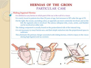 HERNIAS OF THE GROIN
PARTICULAR CASE
Sliding Inguinal Hernia:
It is defined as any hernia in which part of the sac is the wall of a viscus.
It is rarely found in patients less than 30 years of age, but increases to 20% after the age of 70.
On the right, the cecum, ascending colon, or appendix are most commonly involved, and on the
left, the sigmoid colon is involved. The uterus, fallopian tube, ovary, ureter, and bladder
can be involved on either side.
The sliding component is usually found on the posterolateral side of the internal ring.
it is not necessary to resect hernia sacs, and that simple reduction into the preperitoneal space is
sufficient.
This eliminates the primary danger associated with sliding hernias, which is injury to the viscus
during high ligation and sac excision.
 