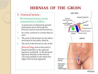 HERNIAS OF THE GROIN
3 - Femoral hernia :
The femoral hernia can be
summarized as follow :
I. A protrusion of abdominal parietal
peritoneum down throwgh the
femoral canal to from the hernial sac.
II. It is more common in women than in
men .
III. The neck of the hernial sac lies below
and lateral to the pubic tubercle.
IV. The neck of the hernial sac lies at the
femoral ring and at that point is
related interiorly to the inguinal
ligament, posterioly to the pectineal
ligament, laterally to the femoral
vien,and medially to the sharp free
edge of the lacunar ligament.
 