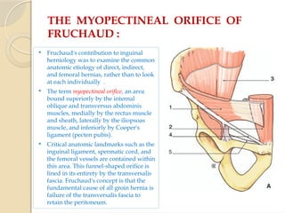 THE MYOPECTINEAL ORIFICE OF
FRUCHAUD :
 Fruchaud's contribution to inguinal
herniology was to examine the common
anatomic etiology of direct, indirect,
and femoral hernias, rather than to look
at each individually .
 The term myopectineal orifice, an area
bound superiorly by the internal
oblique and transversus abdominis
muscles, medially by the rectus muscle
and sheath, laterally by the iliopsoas
muscle, and inferiorly by Cooper's
ligament (pecten pubis).
 Critical anatomic landmarks such as the
inguinal ligament, spermatic cord, and
the femoral vessels are contained within
this area. This funnel-shaped orifice is
lined in its entirety by the transversalis
fascia. Fruchaud's concept is that the
fundamental cause of all groin hernia is
failure of the transversalis fascia to
retain the peritoneum.
 