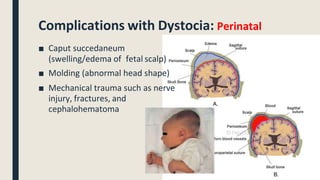 Obstetrics Reference Lec abnormal-labor.pptx