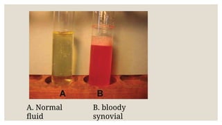 Abnormal body fluids presentation 2.pptx