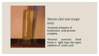Ropy Test Abnormal body fluids presentation 2.pptx
