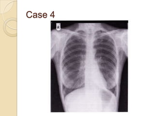 Case 4
 
