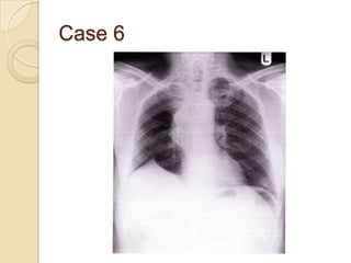 Case 6
 