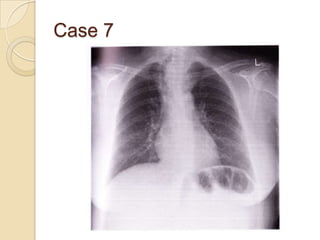 Case 7
 