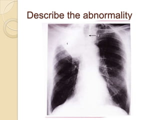 Describe the abnormality
 