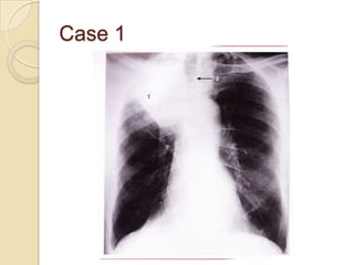 Case 1
 