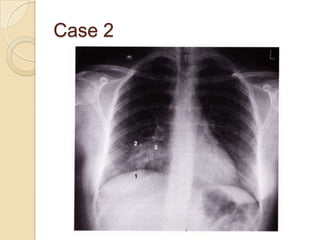 Case 2
 