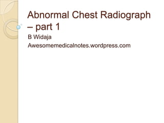 Abnormal Chest Radiograph
– part 1
B Widaja
Awesomemedicalnotes.wordpress.com
 