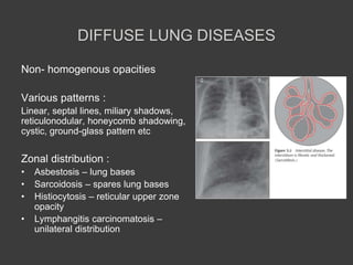 Abnormal Chest X rays | PPTX