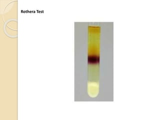 Rothera Test
 
