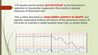 ABNORMAL CTG in high risk pregnancy.pptx
